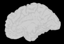 장 건강이 곧 뇌 건강, 당신의 ‘세컨드 브레인’을 관리하라 a white brain on a black background
