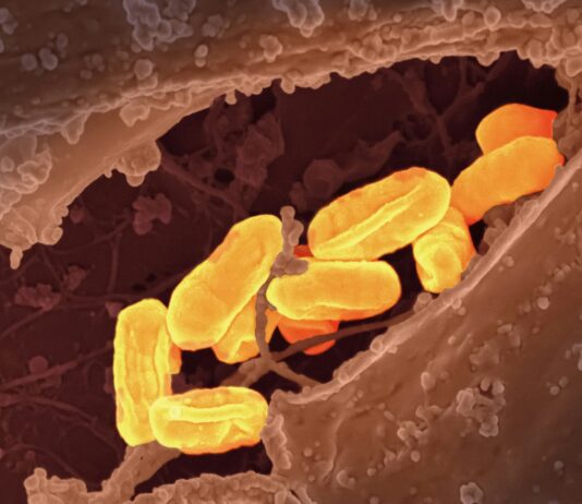 ‘개인 맞춤형 식단’ 트렌드, 건강관리의 새 기준으로 자리 잡다 a close up of a cell phone with a yellow substance on it