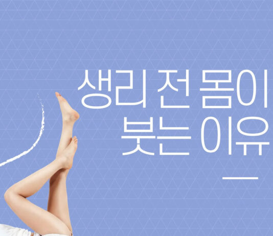 생리 전 몸이 붓는 이유는?…호르몬 변화가 체액 균형에 영향