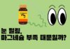 눈 떨림, 마그네슘 부족이 원인일까?